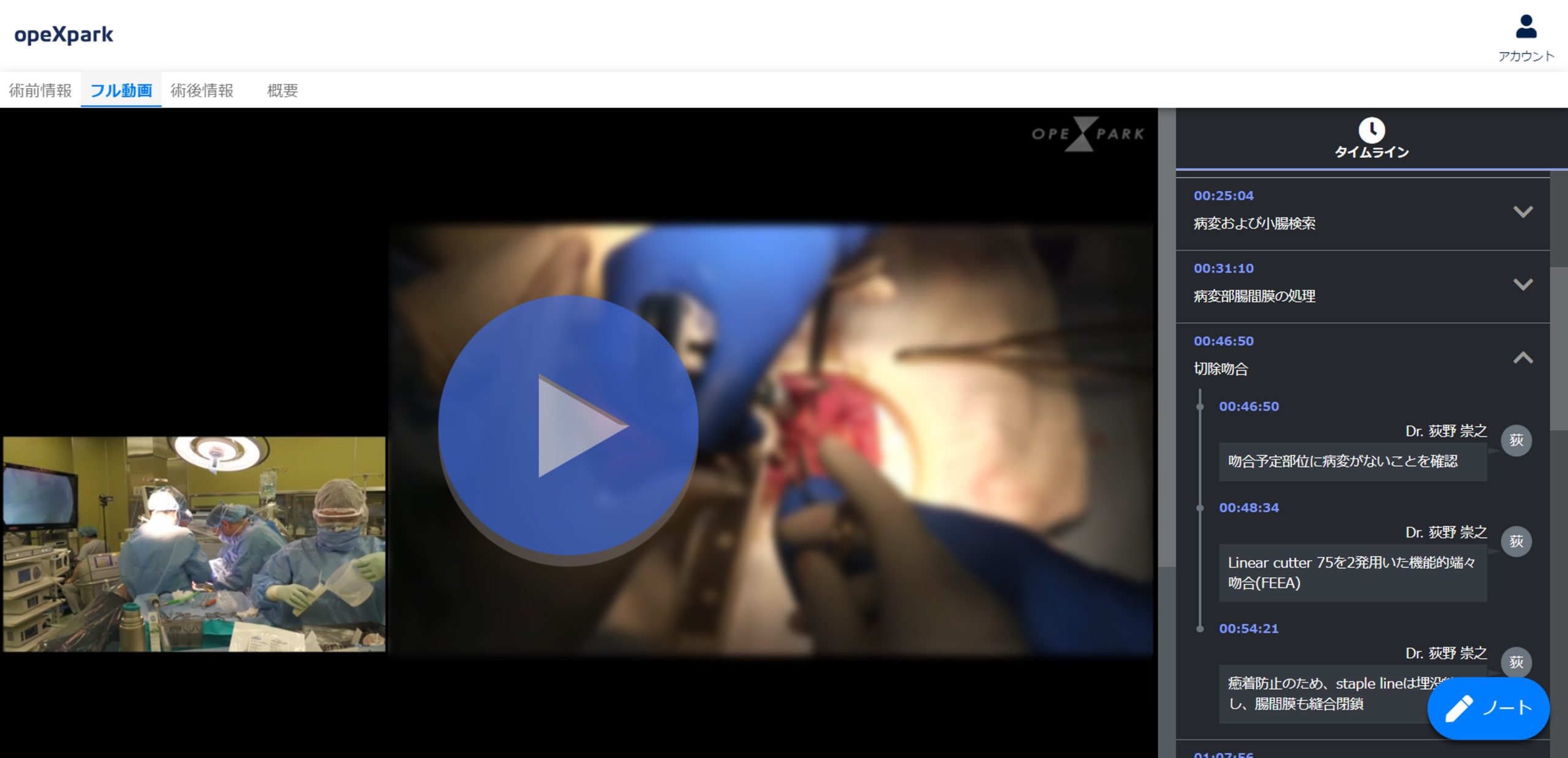 「クローン病に対する腹腔鏡下回盲部切除術」のサムネイル画像